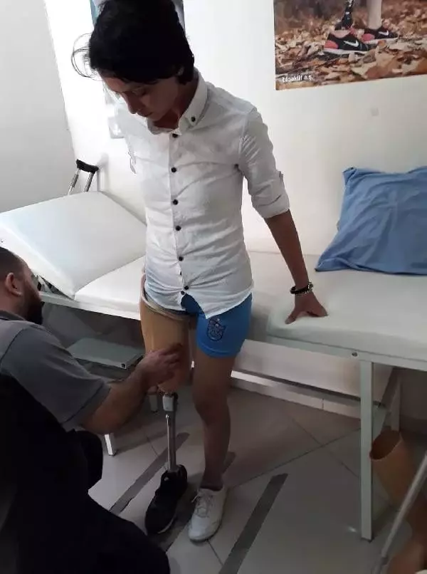 Koca şiddetinde bacağını kaybetti, şimdi kadına karşı şiddet için mücadele edecek