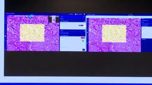 Uluslararası Sağlıkta Yapay Zeka Kongresi sona erdi Uluslararası Sağlıkta Yapay Zeka Kongresi sona erdi