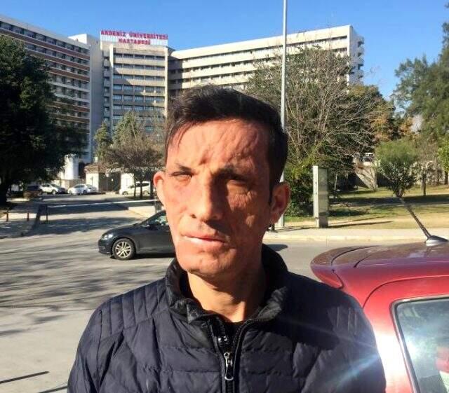 Türkiye'nin ilk yüz nakillisi Uğur Acar: Tek isteğim evlenmek