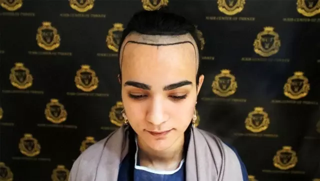Hair Center of Turkey, kadınları saç dökülmesinde çözüme ulaştırıyor Hair Center of Turkey, kadınları saç dökülmesinde çözüme ulaştırıyor