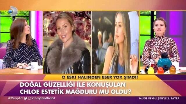 Serdar Ortaç'ın eski eşi Chloe Loughnan, şişen yüzüğüyle dikkatleri üzerine çekti