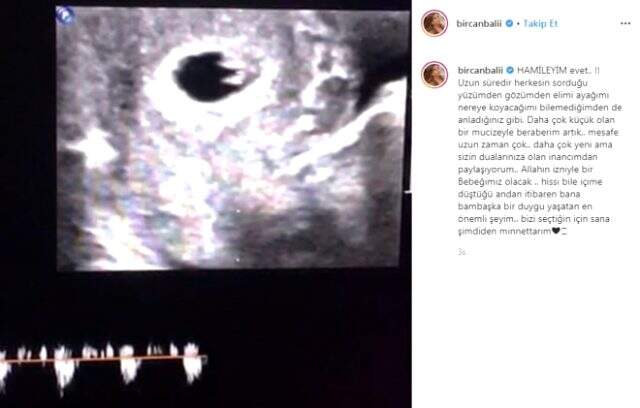 Hamile olduğunu duyuran Bircan Bali, canlı yayında gözyaşlarına hakim olamadı
