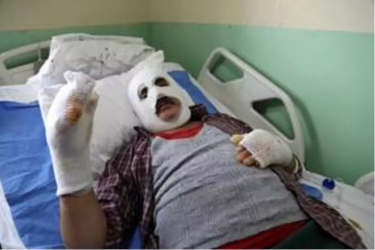 'Köyü yangından kurtarayım' derken canından oluyordu