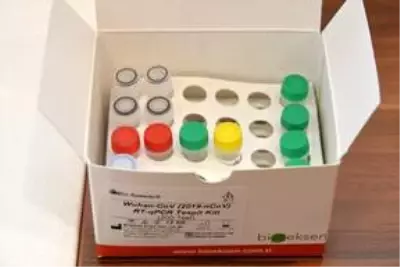 Sağlık Bakanlığı koronavirüs tanı kitini yurt dışına da satacak Sağlık Bakanlığı koronavirüs tanı kitini yurt dışına da satacak