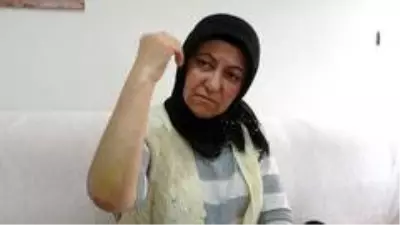 Uçak kazasından yaralı kurtulan kadın: 'Halen şoktayım' Uçak kazasından yaralı kurtulan kadın: 'Halen şoktayım'