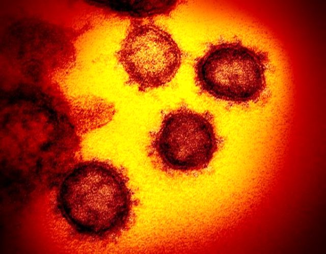 https://foto.haberler.com/haber/2020/02/14/yuzlerce-insanin-cani-alan-koronavirusun-12918143_4980_m.jpg