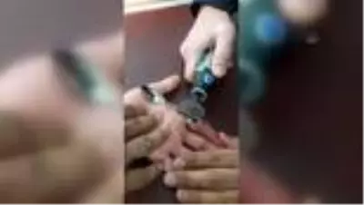 Parmağına sıkışan yüzüğü itfaiye ekipleri çıkarttı Parmağına sıkışan yüzüğü itfaiye ekipleri çıkarttı