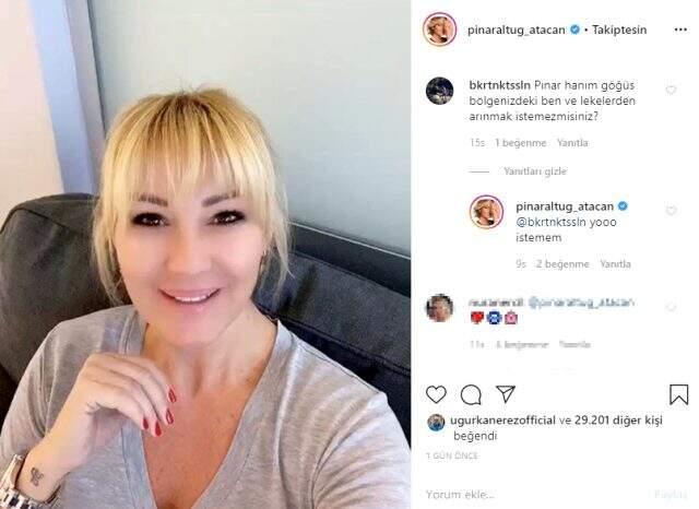 Pınar Altuğ, 'Göğüs bölgenizdeki benleri aldırmak ister misiniz?' sorusuna cevap verdi