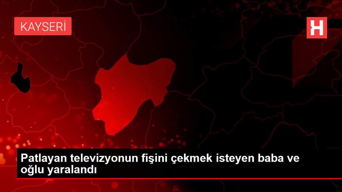 Patlayan televizyonun fişini çekmek isteyen baba ve oğlu yaralandı