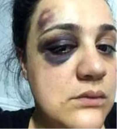 Eşini darp ettiği iddia edilen kocaya verilen cezalar ertelendi Eşini darp ettiği iddia edilen kocaya verilen cezalar ertelendi