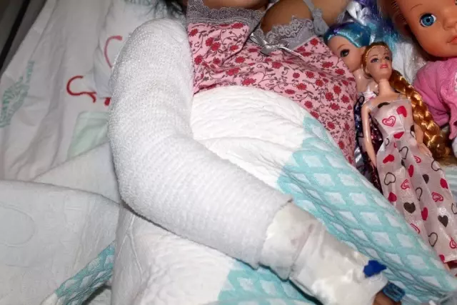 Depremde yanmıştı, küçük kız yapay ve kendi derisinin nakli ile tedavi edildi Depremde yanmıştı, küçük kız yapay ve kendi derisinin nakli ile tedavi edildi