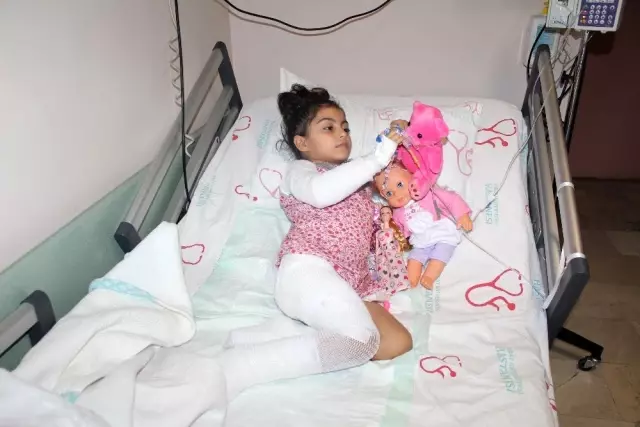 Depremde yanmıştı, küçük kız yapay ve kendi derisinin nakli ile tedavi edildi Depremde yanmıştı, küçük kız yapay ve kendi derisinin nakli ile tedavi edildi