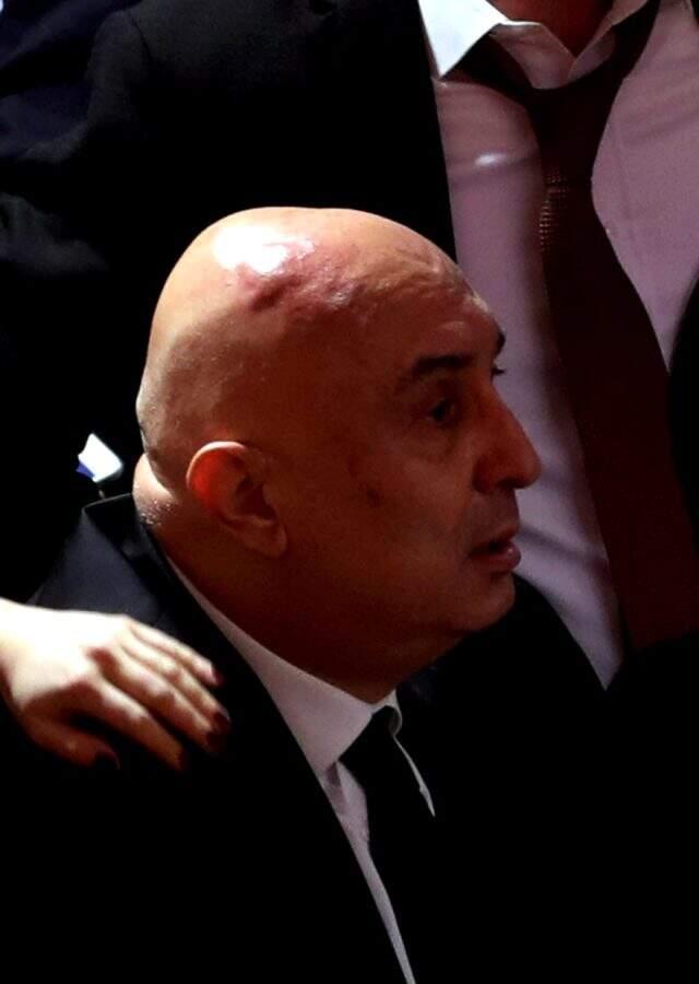 Meclis'teki yumruklu kavga sonrası CHP'li Engin Özkoç'un kafasında ve yüzünde şişlik oluştu
