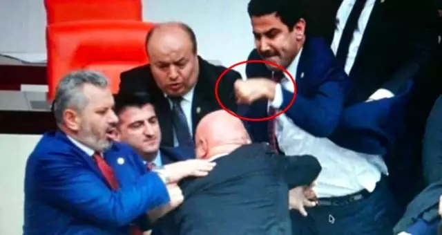 AK Partili vekilin eli, CHP'li Engin Özkoç'a attığı yumruk nedeniyle üç yerden kırıldı AK Partili vekilin eli, CHP'li Engin Özkoç'a attığı yumruk nedeniyle üç yerden kırıldı