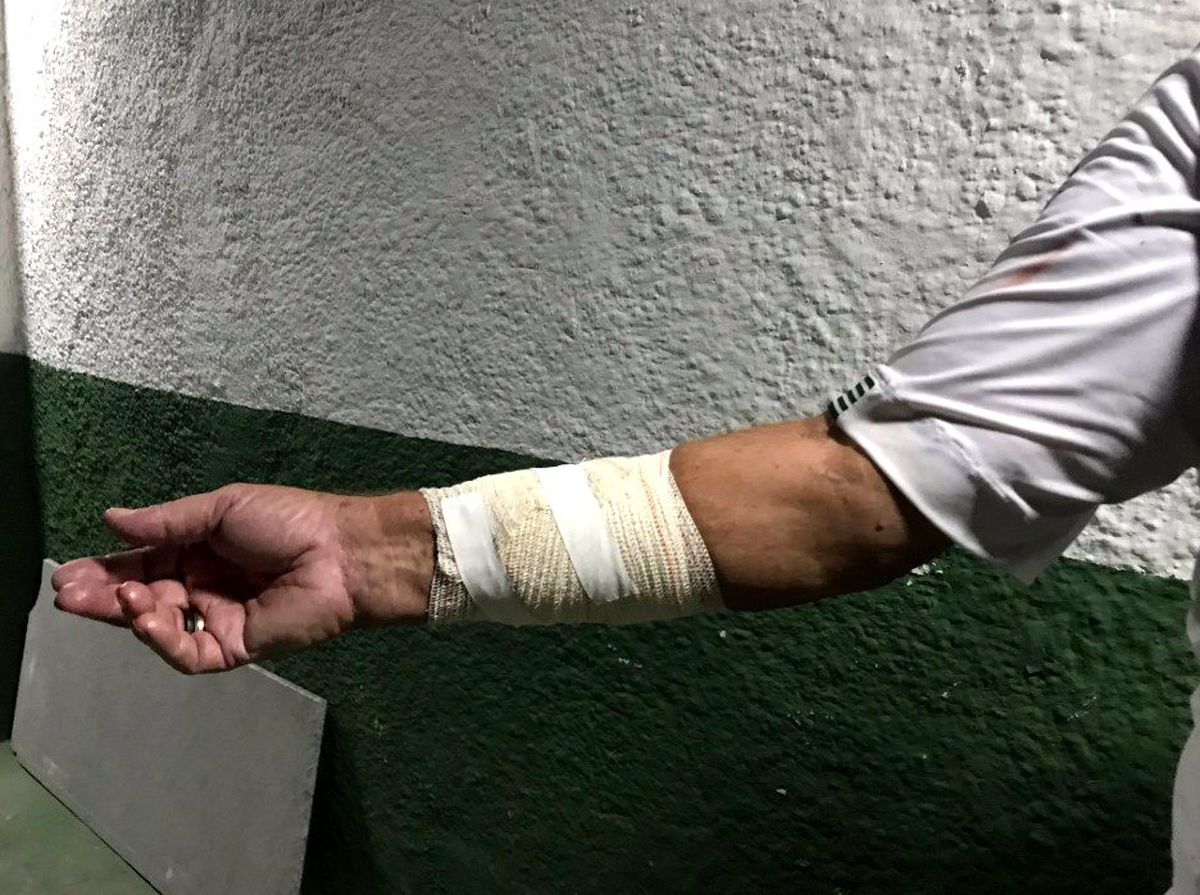 Rakip taraftarlar, Portuguesa'nın soyunma odasını bastı ve teknik ekibe saldırdı