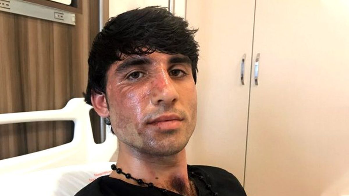 Yunanistan polisi, Avrupa'ya gitmek isteyen Afgan mültecinin yüzüne kaynar su attı