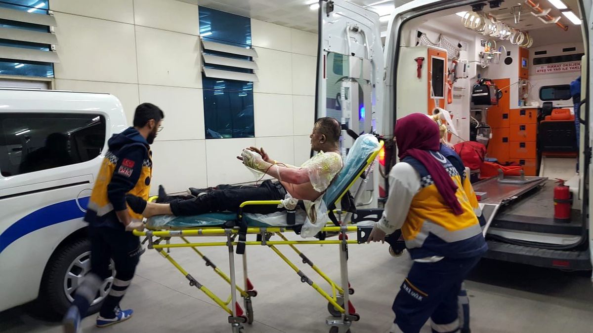 Karısını barışmaya ikna edemeyen adam, benzin dökerek kendini yaktı