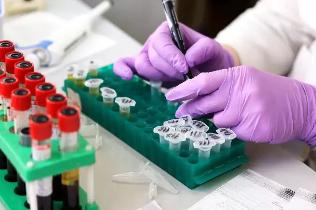 Favipiravir nedir? ÇİN'in duyurduğu Favipiravir ilacının özellikleri nedir? Favipiravir'in corona virüs tedavisinde yararları neler? Koronavirüs ilacı Favipiravir nedir? ÇİN'in duyurduğu Favipiravir ilacının özellikleri nedir? Favipiravir'in corona virüs tedavisinde yararları neler? Koronavirüs ilacı