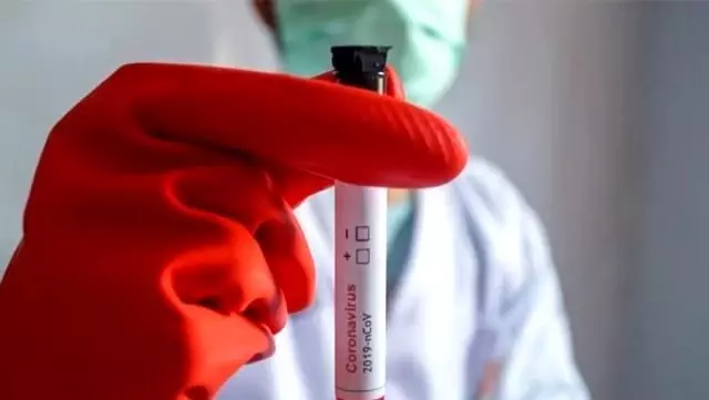 Koronavirüs testi sonuçları nasıl öğrenilir? Kronavirüs test sonuçları sorgulama! Koronavirüs testi sonuçları nasıl öğrenilir? Kronavirüs test sonuçları sorgulama!