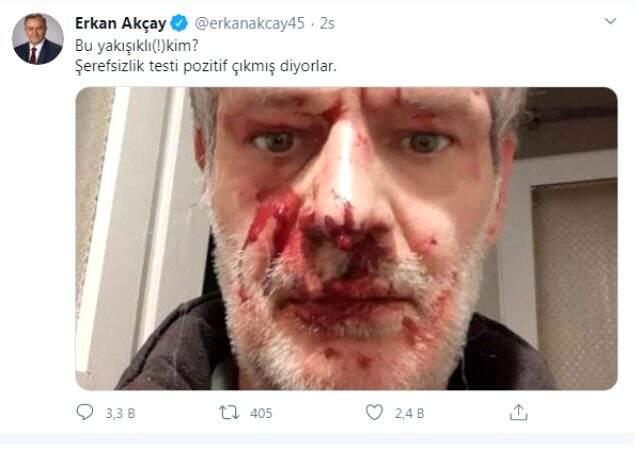 MHP'li Grup Başkanvekili Erkan Akçay, darp edilen yazarın fotoğrafı paylaştı