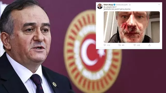 MHP'li Grup Başkanvekili Erkan Akçay, darp edilen yazarın fotoğrafını paylaştı