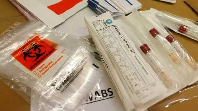 İspanya ve Çekya: Çin'in gönderdiği hızlı test kitleri iyi çalışmıyor İspanya ve Çekya: Çin'in gönderdiği hızlı test kitleri iyi çalışmıyor