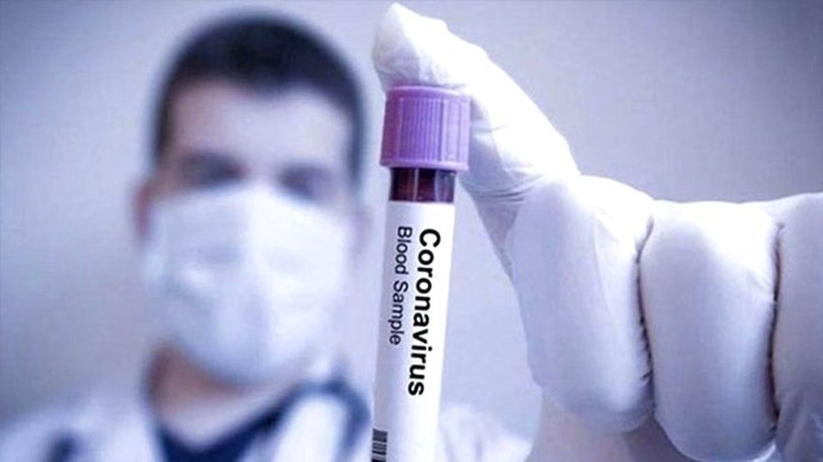DSÖ'den tarihi koronavirüs itirafı: Harekete geçmenin zamanı aslında bir aydan önceydi