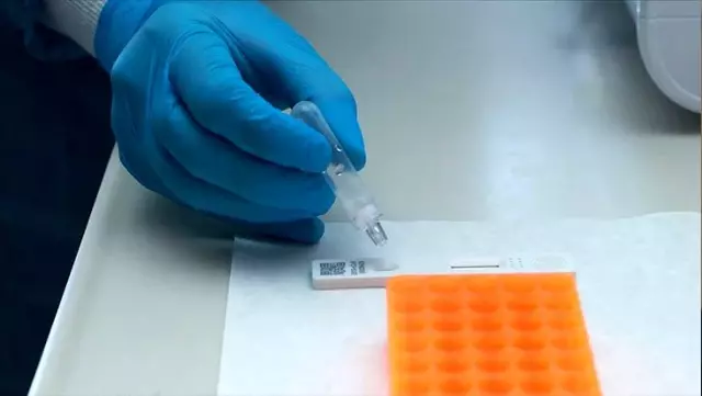 44 ilimizde 73 merkez, koronavirüs tanı laboratuvarı olarak yetkilendirildi