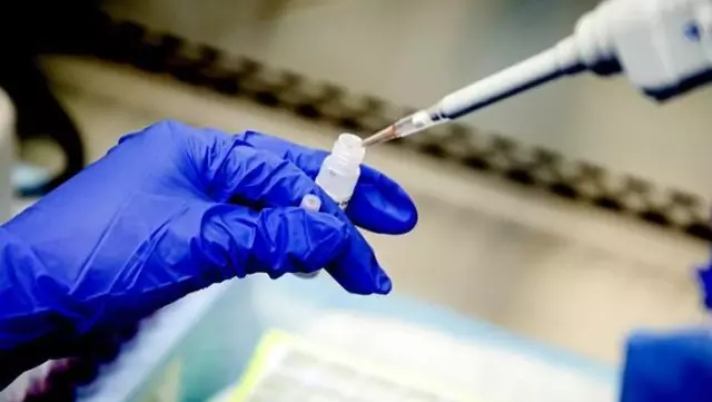 ABD Gıda ve İlaç İdaresi, 2 dakikada sonuç veren koronavirüs testine onay verdi ABD Gıda ve İlaç İdaresi, 2 dakikada sonuç veren koronavirüs testine onay verdi