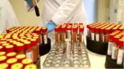İngiltere'de 5 dakikada sonuç veren koronavirüs test cihazı geliştirildi İngiltere'de 5 dakikada sonuç veren koronavirüs test cihazı geliştirildi