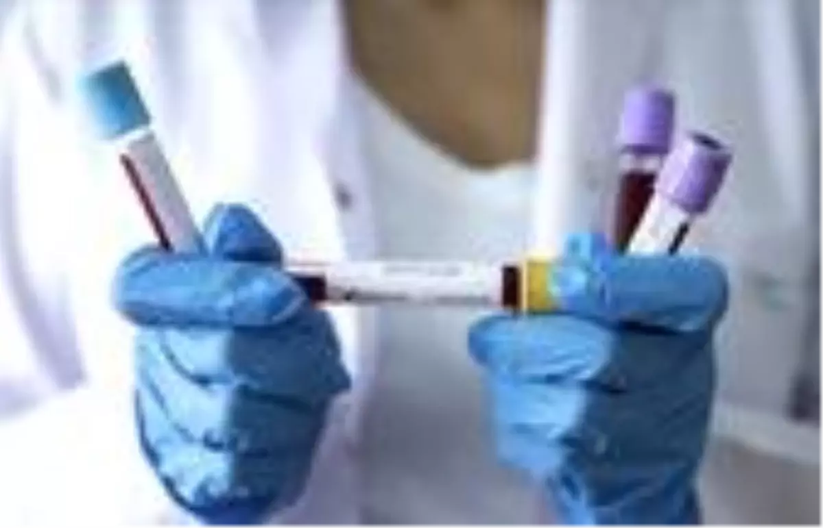 Beş farklı sigorta şirketi,Koronavirüs tedavisini kapsamına aldı