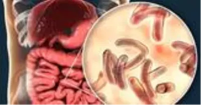Kolera nedir? Kolera hastalığı belirtileri neler? Kolera salgını tedavisi
