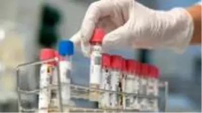 Son Dakika: Dünya genelindeki koronavirüs vaka sayısı 1 milyonu aştı