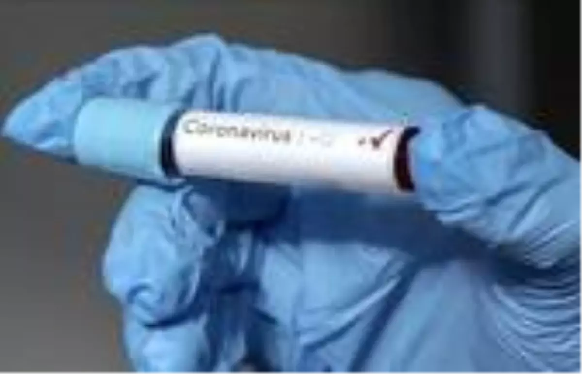 Kovid-19 salgınında '5G' tartışması