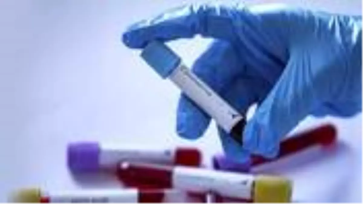 Son dakika: Koronavirüse karşı Ar-Ge projelerinde çalışacaklara 6 bin liraya kadar burs verilecek