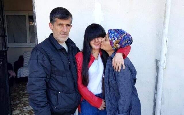 Yüzüne asit döken sevgilisini affeden Berfin Özek konuştu: Ozan'a hakkımı helal ettim