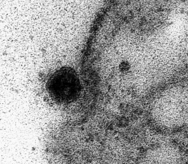 Brezilyalı bilim insanları, koronavirüsün sağlıklı hücrelere saldırdığı anların fotoğrafını yayınladı