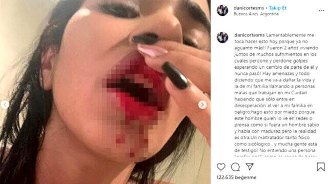 Boca'lı futbolcu sevgilisi Villa'dan şiddet gören Daniela Cortes: Artık dayanamıyorum
