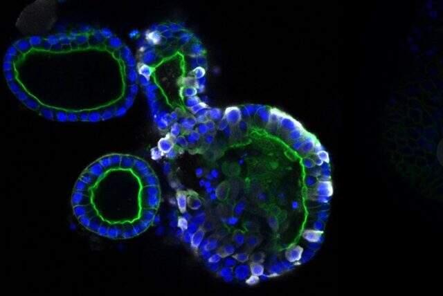 The clearest view of damage! Coronavirus can also multiply in the digestive system.