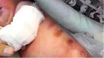 Doğumda ısıtıcıyla yanan bebeğin ailesine, 160 bin lira tazminat ödenecek Doğumda ısıtıcıyla yanan bebeğin ailesine, 160 bin lira tazminat ödenecek
