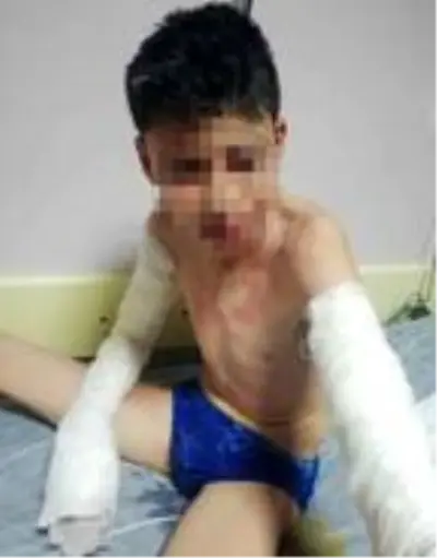 3'ü çocuk 6 kişiyi kezzapla yaralamıştı, yeniden yargılanacak