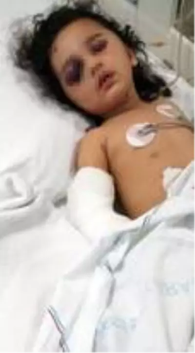 Üçüncü kattan düşerek ağır yaralanan çocuk Ankara'ya sevk edildi