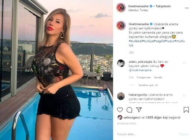 Kalça estetiği yaptıran Linet, mini şortuyla poz verdi Kalça estetiği yaptıran Linet, mini şortuyla poz verdi