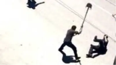 Akıl hastası vatandaşın kürekli saldırısına maruz kalan komiser silahını neden kullanmadığını anlattı Akıl hastası vatandaşın kürekli saldırısına maruz kalan komiser silahını neden kullanmadığını anlattı