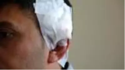 Kürekli saldırıda yaralanan komiser: Silah kullanmamakla en doğru kararı verdim Kürekli saldırıda yaralanan komiser: Silah kullanmamakla en doğru kararı verdim