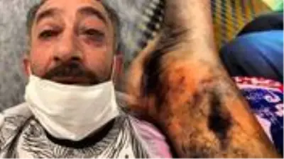 15 Temmuz gazisinin yürek burkan dramı! Devlet büyüklerinden yardım bekliyor 15 Temmuz gazisinin yürek burkan dramı! Devlet büyüklerinden yardım bekliyor