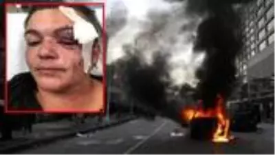 ABD'de devam eden protestolarda bir gazeteci gözünden vuruldu ABD'de devam eden protestolarda bir gazeteci gözünden vuruldu