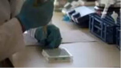 ELISA testi ile hem koronavirus hem de antikorları daha çabuk tespit edilebilecek ELISA testi ile hem koronavirus hem de antikorları daha çabuk tespit edilebilecek