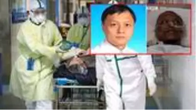Koronavirüse yakalanan ve ten rengi koyulaşan Çinli doktor Hu Weifeng hayatını kaybetti