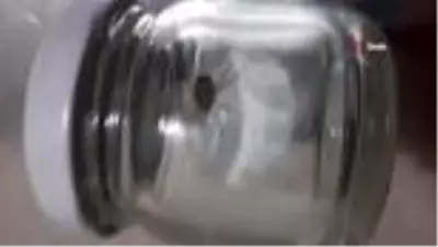 Üzerinde gezinirken yakaladığı keneyi, doğaya bıraktı Üzerinde gezinirken yakaladığı keneyi, doğaya bıraktı